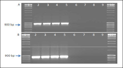 Wolbachia specific ftsZA (A) and ftsZB (B) group specific primer that amplifies at around 950 bp; lanes 1 and 10, molecular weight marker (10 kb ladder MBI-Fermentas, USA), lanes 2 and 3, Wolbachia in male Uzi flies, lanes 4 to 5, Wolbachia in female Uzi flies