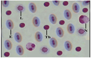 Fig: Microphotograph of blood smear of control G. gotyla gotyla showingerythrocytes (E), neutrophils (N), lymphocytes (L) and thrombocytes (Th) (100x).