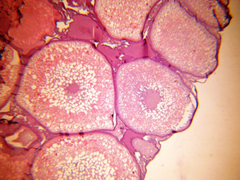 Fig 1: Microphotograph showing previtellogenic oocytes with well-developed nucleus (N).
