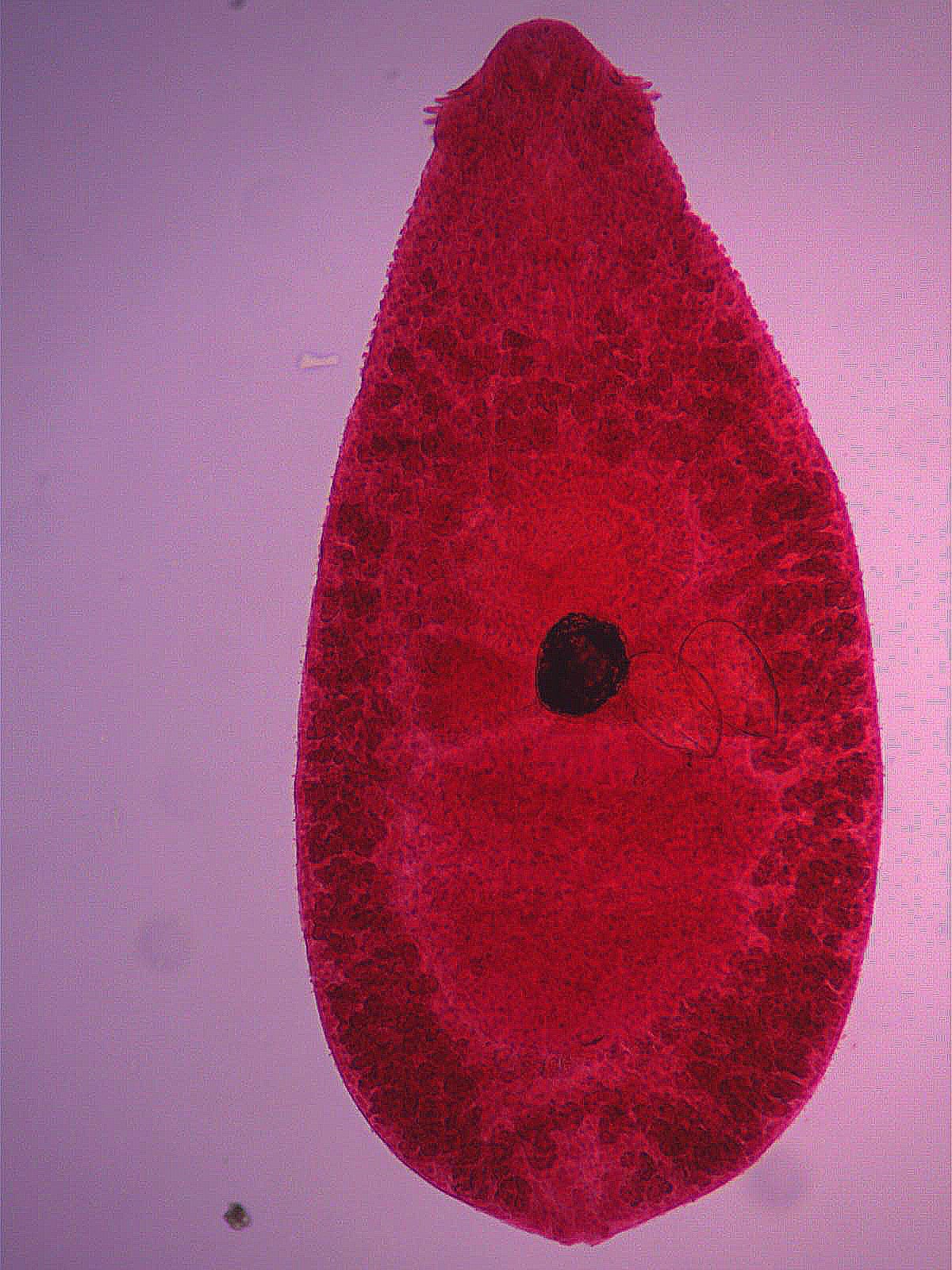 Echinochasmus mazharuddini n.sp. 
