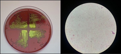 Typical metallic sheen of <em>E. coli</em> on EMB agar and <em>E. coli </em>stained as gram negative pink rods