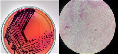 Black centered colonies of <em>Salmonella </em>spp. on XLD agar and <em>Salmonella</em> stained as gram negative pink rods