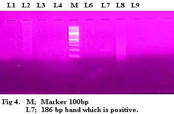 M; Marker 100bp L7; 186 bp band which is positive.