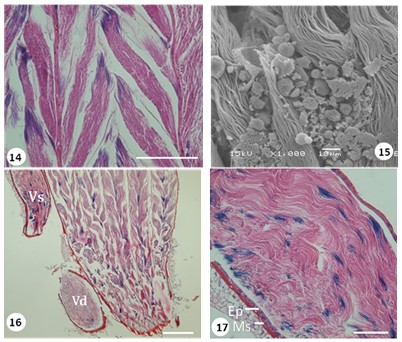 Light and SEM photos of spermatozoa bundles in differentiation zones the testes follicles of G. lineatum (Bar 100µm).