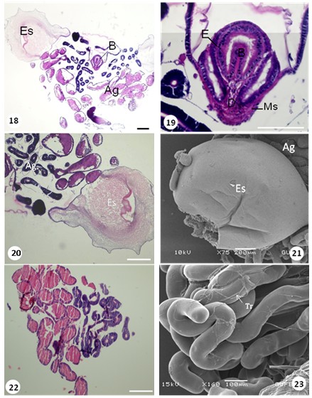 epitelium, ductus ejaculatorius