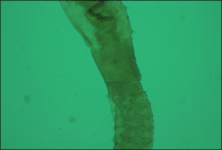 Budding zone- Aulophorus furcata