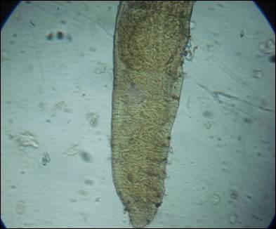 Dero digitata-Anterior region
