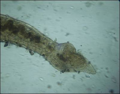 Dero digitata-Posterior region